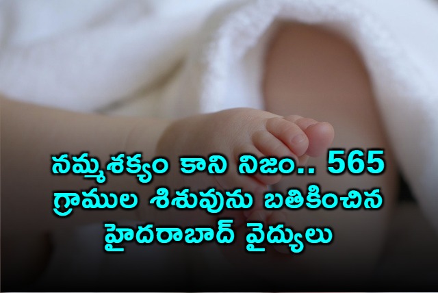 Hyderabad Doctors Save 565 Gram Premature Baby A Miracle