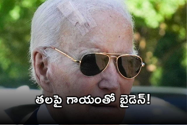 Joe Biden Appears Frail With Head Injury