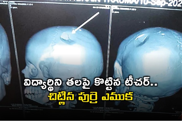 Teacher Hits Student on Head in Chittoor Skull Fractured