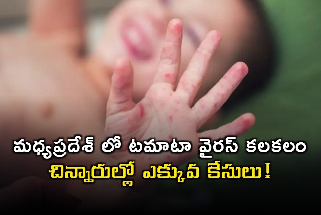 Tomato Virus Outbreak in Madhya Pradesh Affects Children