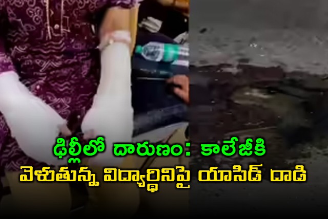 Acid Attack Delhi student attacked with acid in Ashok Vihar