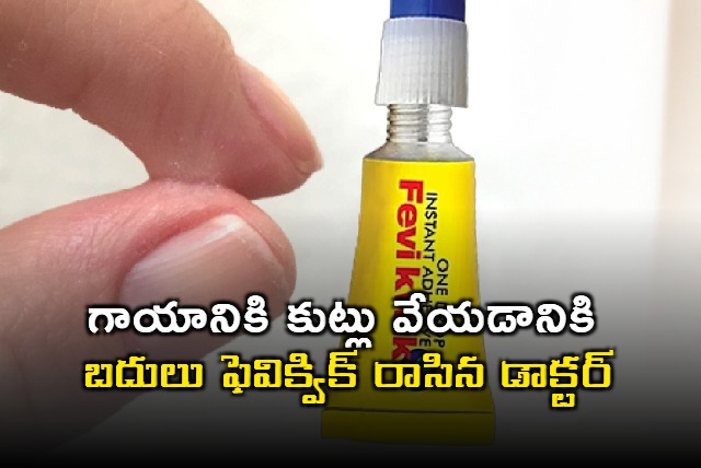 Meerut Doctor uses Fevikwik instead of stitches on childs head