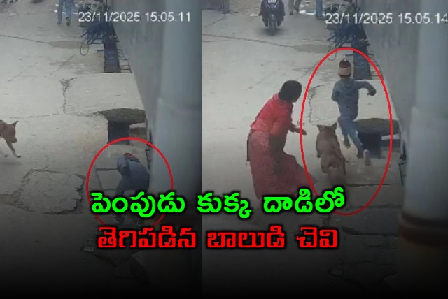 Pitbull attack Boy severely injured in Delhi