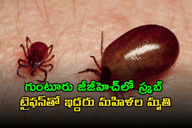 Guntur GGH Two Women Died with Scrub Typhus