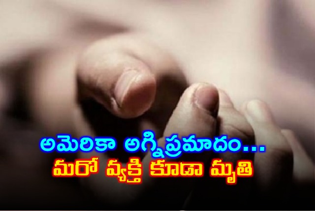 Anvesh Dies in US Fire Accident