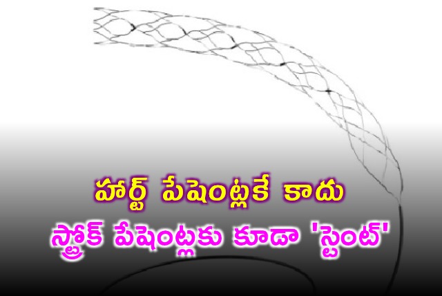 AIIMS Delhi Supernova Stent Effective for Stroke Patients