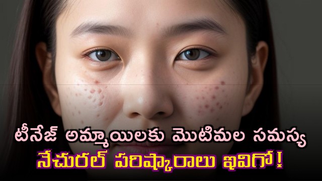 Teenage Acne Problem Natural Solutions
