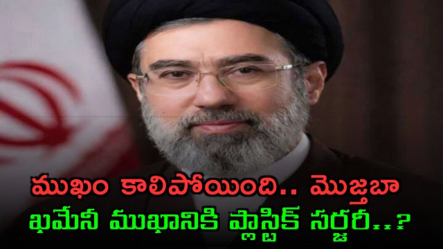 Mojtaba Khamenei Severely Injured Faces Plastic Surgery Report