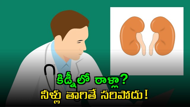 New study says drinking more water not a sollution for kidney stones