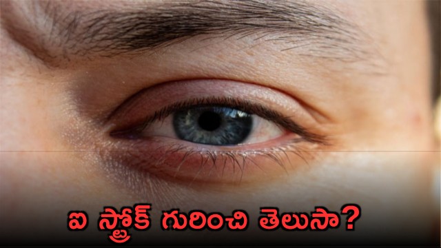 Eye Stroke What You Need to Know About Symptoms and Risks