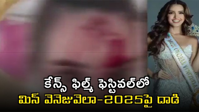 Miss Venezuela 2025 Shares Video Showing Injuries After Alleged Assault By Celebrity Stylist