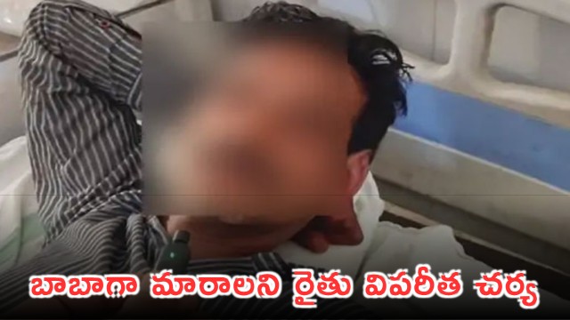 Madya Pradesh Farmer Mutilates Himself With Axe To Become An Ascetic