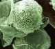 Green fungus case found in Madhya Pradesh