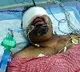 Kathi Mahesh eye injured in accident