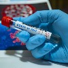 AP Corona Positive Cases and Deaths