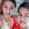 Fear Separation Twins End Life
