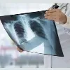 New guidelines from Union health ministry