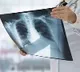 New guidelines from Union health ministry