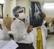4 people died in telangana with black fungus
