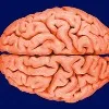 Woman recites Hanuman Chalisa while critical brain surgery at AIIMS