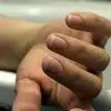 Man suicide in guntur after they attack