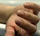 Man suicide in guntur after they attack