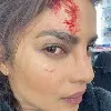 Priyanka Chopra got injured during Citadel web series shooting