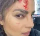 Priyanka Chopra got injured during Citadel web series shooting