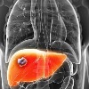 How a toxic liver can affect your health