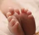 Baby Born In Brazil With 12cm Long Appendage