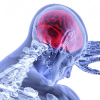 Man with rare co-occurrence of brain haemorrhage & heart treated successfully