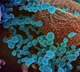 Norovirus confirmed in Kerala