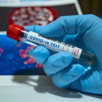 AP Corona Daily Cases report