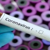 Mysuru on alert as 72 nursing students test positive for Covid-19