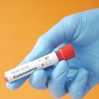 Omicron variant doesnt escape RT PCR and RAT