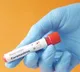 Omicron variant doesnt escape RT PCR and RAT