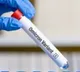 Omicron cases in UK rise by 50% in one day