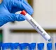 Two more Omicron positive cases identified in Mumbai