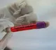 First Omicron case in Kerala