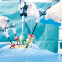 156 renal stones from removed from man at Hyderabad hospital