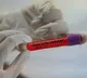 Four more Omicron variant positive cases identified in Telangana