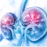 KIMS Icon hospital creates history.. Successfully performs complex kidney surgery