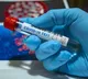 Telangana corona report