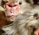 woman Hospitalized with monkey fever