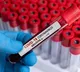 Omicron Generated Antibodies Effective Against All Variants Including Delta