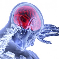 Stroke risk in elderly highest in 3 days after Covid-19 diagnosis