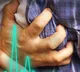People infected with Covid19 at increased risk of developing heart conditions up to a year later