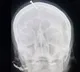 Fake baba drills nail into pregnant lady head to give birth to a baby boy