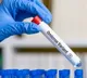 Omicron subvariant makes up nearly one quarter of new Covid cases in US