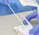 BA2 version of Omicron identified in 18 percent samples in Tamil Nadu